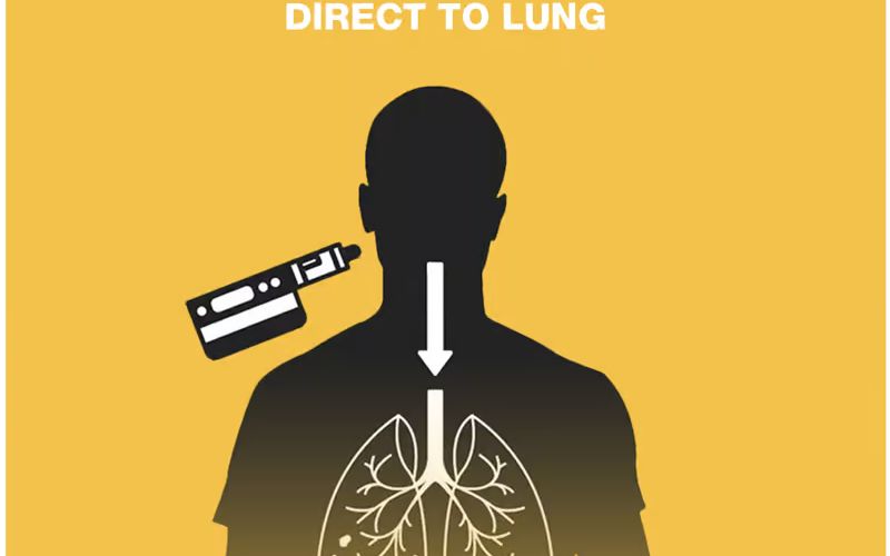 thuật ngữ Direct To Lung